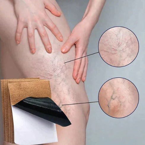 VEINS CARE 2x1 PARCHES PARA VARICES Y ALIVIO DE MOLESTIAS + ENVIO GRATIS A TODO GUATEMALA