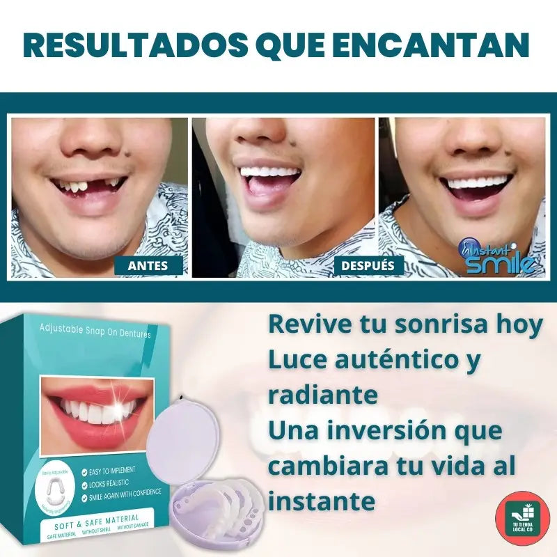 Carilla *PROMO DENTAL OFERTA DE 2X1 + ENVIO GRATIS 🎁