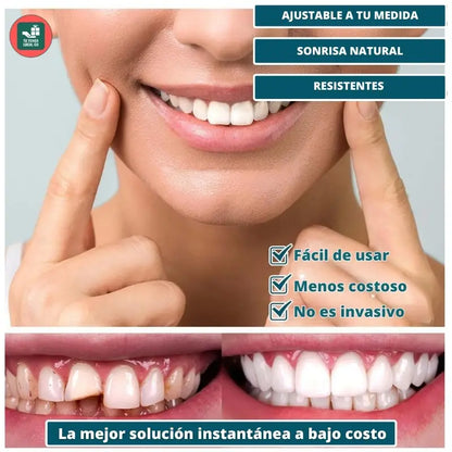Carilla *PROMO DENTAL OFERTA DE 2X1 + ENVIO GRATIS 🎁